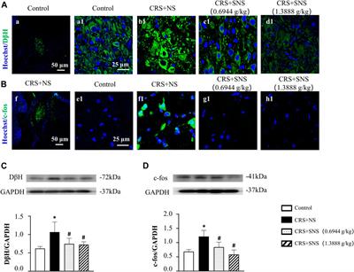 Ameliorative effect and mechanism of Si-Ni-San on chronic stress-induced diarrhea-irritable bowel syndrome in rats